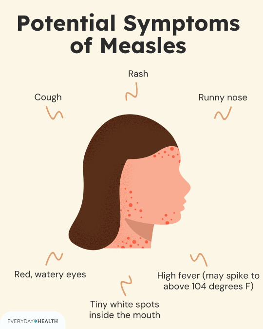 Graphic showing symptoms of measles